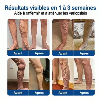 Patch Anti-Varices