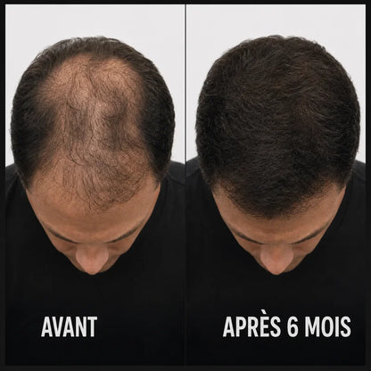 Sérum capillaire densifiant avec brosse applicatrice